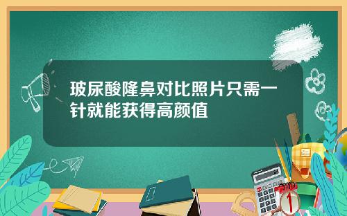 玻尿酸隆鼻对比照片只需一针就能获得高颜值