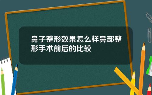鼻子整形效果怎么样鼻部整形手术前后的比较