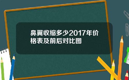 鼻翼收缩多少2017年价格表及前后对比图
